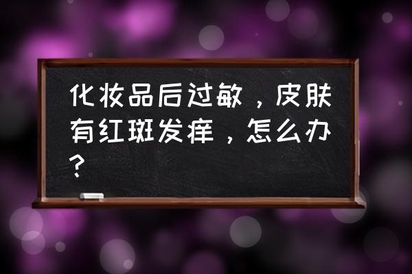 化妆品皮肤过敏红痒怎么办 化妆品后过敏，皮肤有红斑发痒，怎么办？