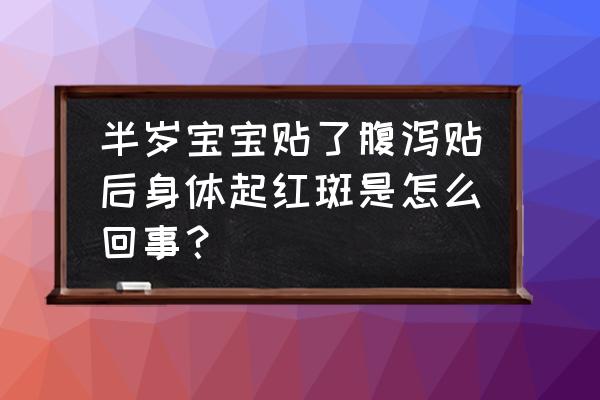 小儿腹泻贴的危害 半岁宝宝贴了腹泻贴后身体起红斑是怎么回事？