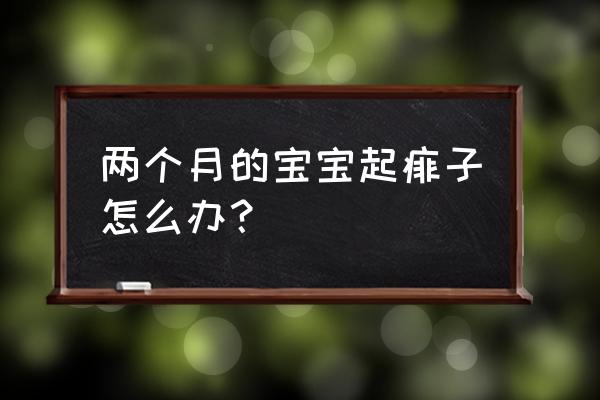 怎样去除痱子最快方法 两个月的宝宝起痱子怎么办？